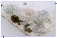 Schimmel Aussenecke im Deckenbereich